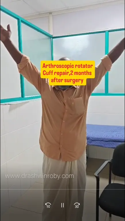 A patient after arthroscopic rotator cuff repair 2 months after surgery